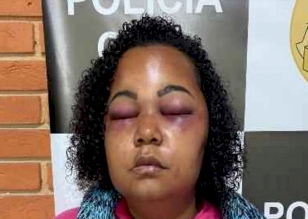 ‘Só sobrevivi porque fingi estar morta’, diz professora que foi espancada pelo marido