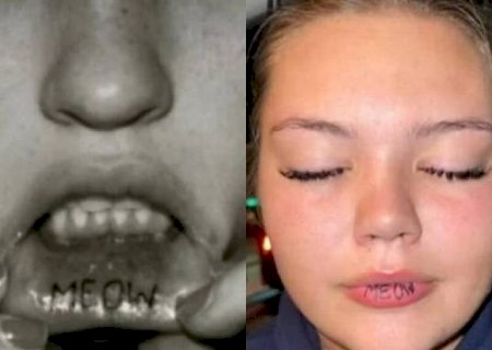 Jovem faz tatuagem na boca e se arrepende