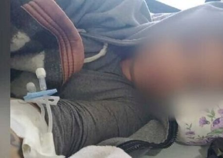 Mulher com hemorragia está prestes a conseguir cirurgia para retirada do útero em MS