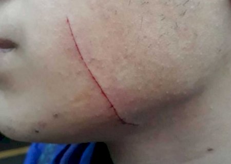 Mulher agride marido após encontrar mensagens com ex no celular