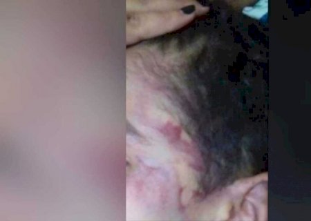 Mulher é espancada ao pedir silêncio para o marido não acordar o filho em Dourados