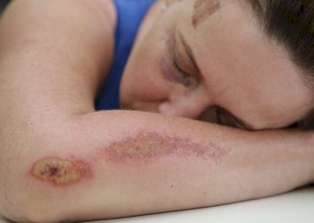 Nos primeiros dez dias do ano, quase 500 mulheres sofreram viol&ecirc;ncia dom&eacute;stica