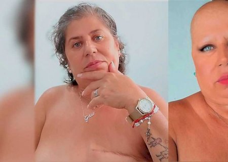 Mulher que venceu dois cânceres luta para reconstruir autoestima e corpo em Campo Grande