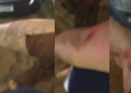 Motorista de app é mordido por passageira em briga por pagamento de corrida em Dourados