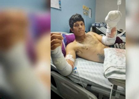 Trabalhador sofre descarga elétrica, tem mãos queimadas e teme perder movimentos