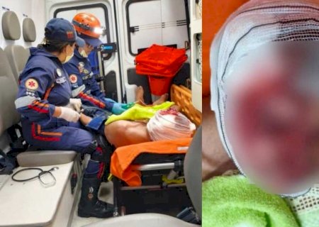 Idoso é atacado por cachorro e sofre múltiplas lacerações no rosto em Aquidauana