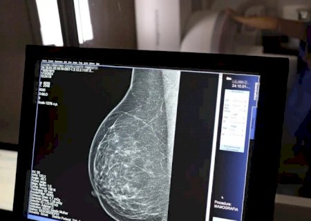 Plano de saúde terá que cobrir mamografia digital para todas as idades