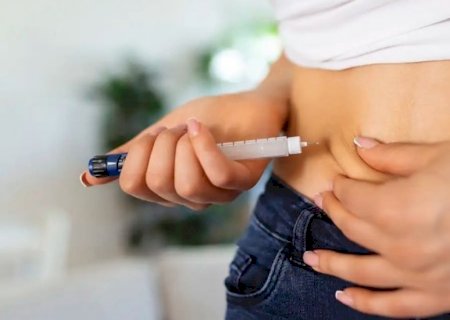SUS avalia inclusão de medicamentos para obesidade