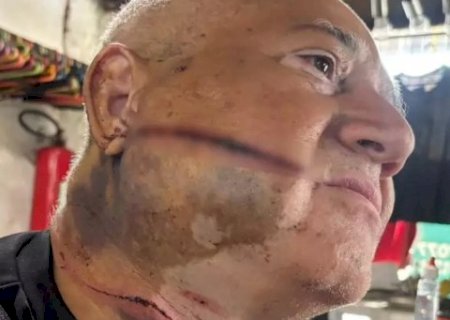 &ldquo;Me livrei da morte 2 vezes&rdquo;, diz comerciante ferido em tentativa de roubo